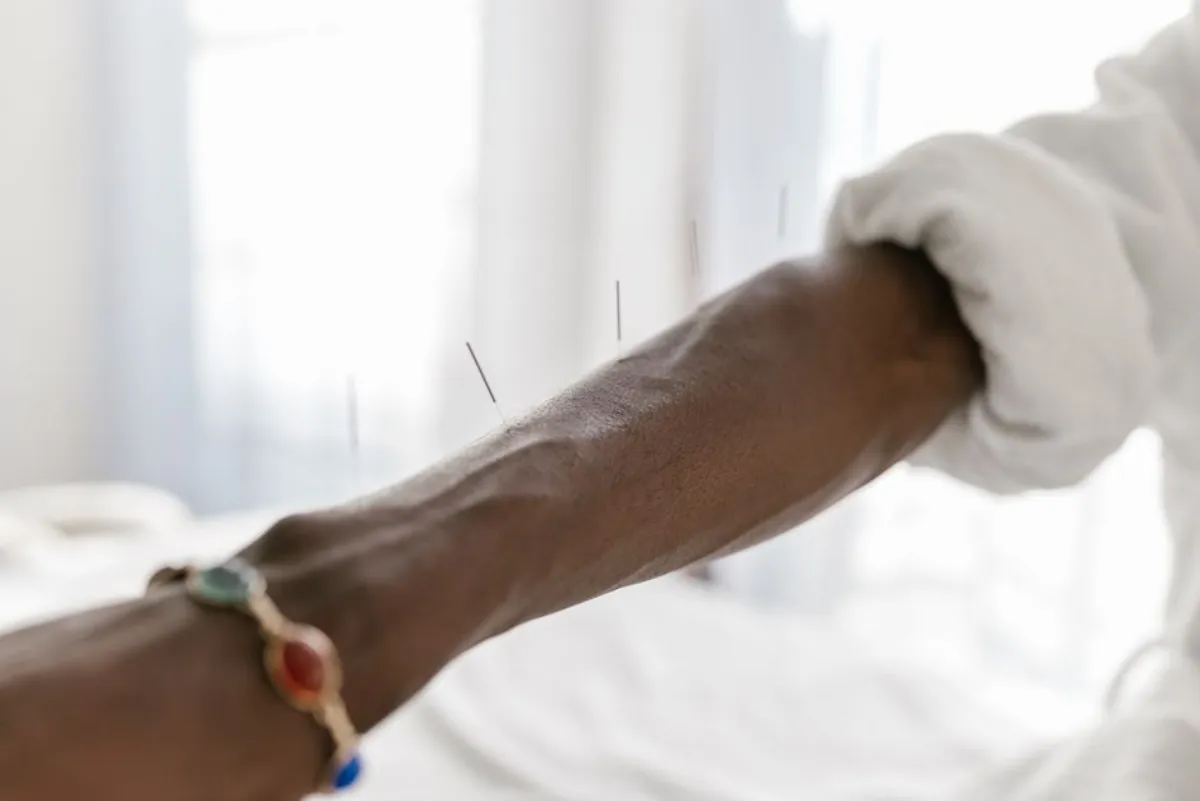 acupuncture meridians